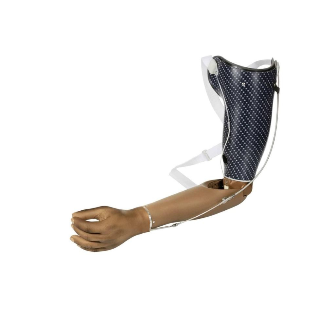 Upper Limb Prosthesis